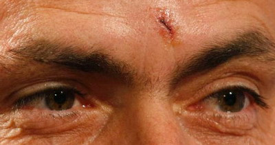 POZA ZILEI: Jose Mourinho si-a spart capul cu portiera de la masina!_1
