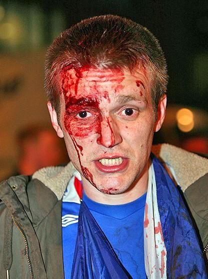 Zona de razboi la Manchester! Un suporter rus injunghiat dupa finala Cupei UEFA! VEZI IMAGINI!_1
