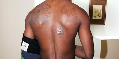FOTO SOCANT: Cum arata Akakpo dupa ce a primit doua gloante in Africa:_1
