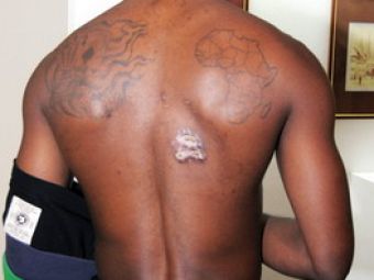 FOTO SOCANT: Cum arata Akakpo dupa ce a primit doua gloante in Africa: