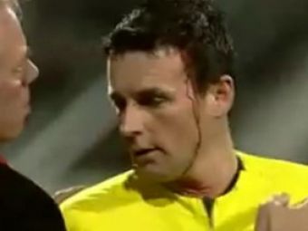 VIDEO: Cazul Bricheta in UEFA: plin de SANGE dupa ce a fost lovit in cap, arbitrul Ceferin nu a intrerupt meciul NEC - Hamburg!