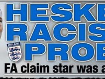 Heskey- victima injuriilor rasiste in meciul contra Croatiei 