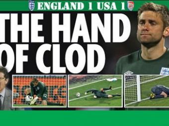 
	The Hand of Clod! Cum se apara Green dupa cea mai mare gafa a unui portar englez!
