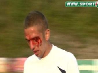 
	VIDEO Dinamo - U Cluj s-a lasat cu sange! Balaj a eliminat doi jucatori pentru bataie!
