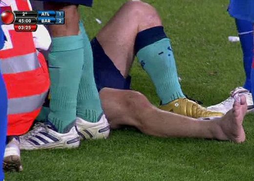 FOTO GROAZNIC! Cum arata piciorul lui Messi dus la spital dupa Atletico! Vezi ce au declarat medicii!_1