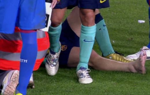 FOTO GROAZNIC! Cum arata piciorul lui Messi dus la spital dupa Atletico! Vezi ce au declarat medicii!_9