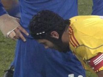 
	Chivu a aflat diagnosticul dupa accidentarea din meciul cu Italia! Vezi cat va sta pe bara
