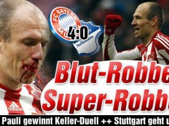 
	FOTO HORROR! Robben, lasat in SANGE la meciul lui Bayern cu Hoffenheim!
