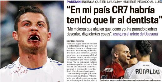 Imaginea care a SOCAT Spania: "In tara mea il trimiteam la DENTIST pe Cristiano Ronaldo!" Cum a fost salvat CR7_1