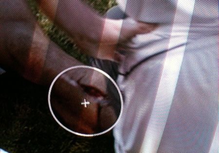 I-a sfasiat gamba! ASA arata piciorul lui Nani dupa faultul lui Carragher! VIDEO:_1