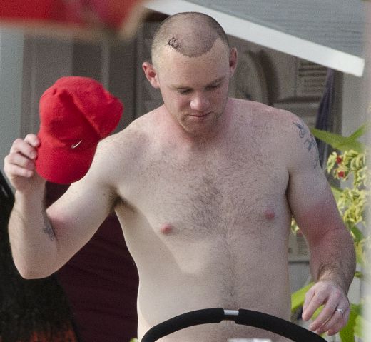 FOTO / Cum arata Rooney dupa operatie! A plecat in vacanta cu familia:_2