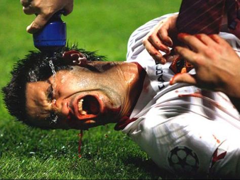 VIDEO: Chivu are nasul fin: a umplut de sange un blatist! Primul 11 al jucatorilor din Serie A in care n-ar trebui sa ai incredere:_1