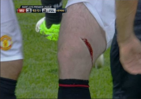 Scene HORROR pe Old Trafford! Rooney, cu piciorul plin de SANGE dupa o intrare CRIMINALA! A parasit terenul in lacrimi! VIDEO_1