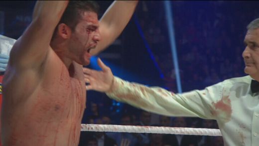 Vitali Klitschko ramane cu centura WBC! Plin de sange, Manuel Charr a turbat de nervi dupa decizia doctorului! Vezi ce s-a intamplat! VIDEO_9