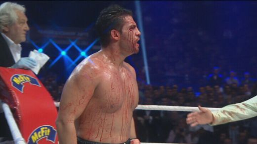 Vitali Klitschko ramane cu centura WBC! Plin de sange, Manuel Charr a turbat de nervi dupa decizia doctorului! Vezi ce s-a intamplat! VIDEO_10
