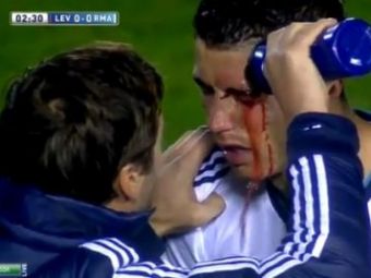 
	Omul care l-a SPART pe Ronaldo e un MACELAR si o URASTE pe Real! Atacul ORIBIL care putea sa-i distruga cariera unui fotbalist GIGANTIC! VIDEO INCREDIBIL
