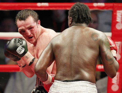 FOTO HORROR! A fost DESFIGURAT in ring! Cum arata un boxer dupa ce a fost calcat in picioare la categoria grea!_2