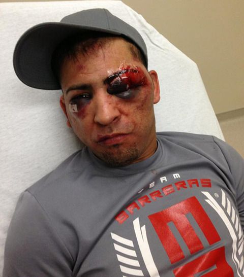 FOTO SOC! Luptator de MMA, desfigurat dupa ce a fost facut KO in cusca! Imaginea cu care si-a ingrozit fanii!_2