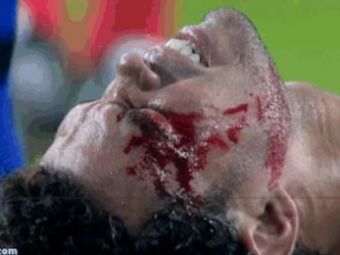 
	Moment HORROR in Liga Campionilor! Pepe a fost ajuns de toate blestemele fanilor Barcei! A fost cusut chiar pe teren: VIDEO
