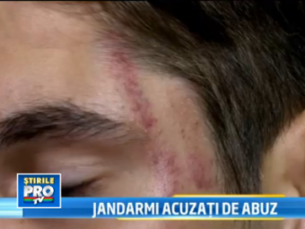 
	Acuzatii INCREDIBILE la adresa Jandarmeriei: pumni si picioare in stanga si-n dreapta! Un suporter a fost batut groaznic in Bucuresti:
