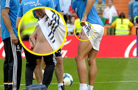 Poza care ii sperie pe sefii lui Real Madrid! Cum arata o accidentare de 100.000.000 de euro! FOTO_2