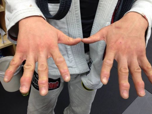 Parca e un mutant din X-MEN! Vezi cum arata mainile acestui sportiv la sfarsitul antrenamentului! FOTO_2