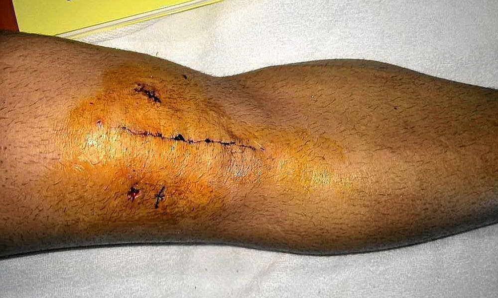S-a complicat situatia lui Jese Rodriguez: jucatorul Realului a fost dus la spital in urma cu putin timp!_2