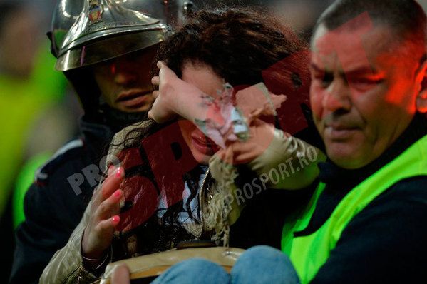 FOTO: Incident pe National Arena! O tanara a ajuns la spital dupa ce a fost lovita de o petarda. Care e starea ei_2