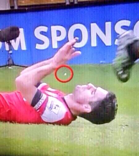 Scene de groaza in Premier League! Un STAR de la Arsenal a ramas fara dinti pe teren. Ce s-a intamplat FOTO_1