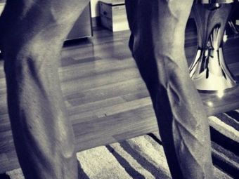 
	Cum arata picioarele acestui sportiv dupa mii de ore de antrenament. FOTO
