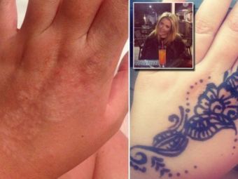 
	A vrut sa-si faca acest tatuaj pe mana, dar ce a iesit a lasat-o marcata pe viata! Cum arata acum. FOTO
