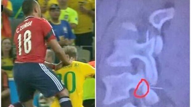 
	FOTO CUTREMURATOR! Neymar putea sa aiba soarta lui Nesu! Brazilianul a fost la 2 cm de drama!&nbsp;
