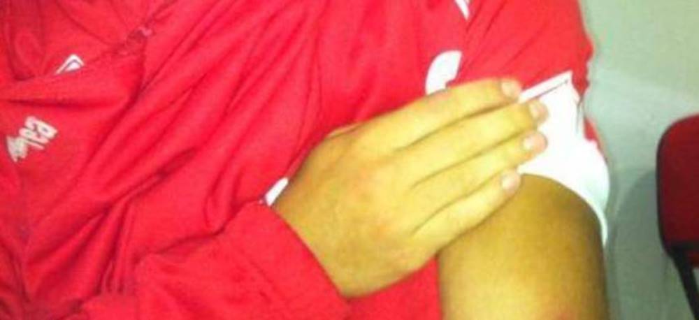 FOTO: Un nou caz SUAREZ in fotbal sub ochii unui ROMAN! Cum arata mana acestui fotbalist dupa ce a fost muscat pe teren_2