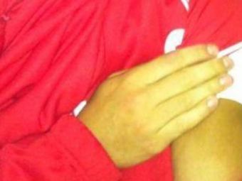
	FOTO: Un nou caz SUAREZ in fotbal sub ochii unui ROMAN! Cum arata mana acestui fotbalist dupa ce a fost muscat pe teren
