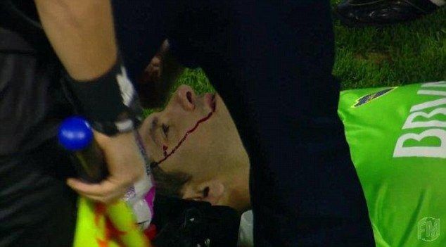 Imagini socante din Argentina! Portarul lui Boca Juniors a cazut, in sange, pe gazon, dupa ce a fost lovit de o piatra in cap _2