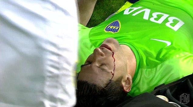 Imagini socante din Argentina! Portarul lui Boca Juniors a cazut, in sange, pe gazon, dupa ce a fost lovit de o piatra in cap _3