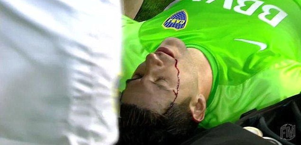 Imagini socante din Argentina! Portarul lui Boca Juniors a cazut, in sange, pe gazon, dupa ce a fost lovit de o piatra in cap _4