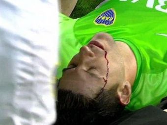 
	Imagini socante din Argentina!&nbsp;Portarul lui Boca Juniors a cazut, in sange, pe gazon, dupa ce a fost lovit de o piatra in cap&nbsp;
