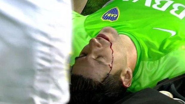 
	Imagini socante din Argentina!&nbsp;Portarul lui Boca Juniors a cazut, in sange, pe gazon, dupa ce a fost lovit de o piatra in cap&nbsp;
