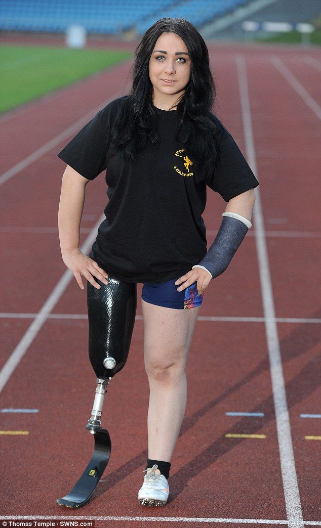 Decizia UNICA a acestei tinere. Le-a cerut medicilor sa-i AMPUTEZE piciorul ca sa alerge mai bine! FOTO_1