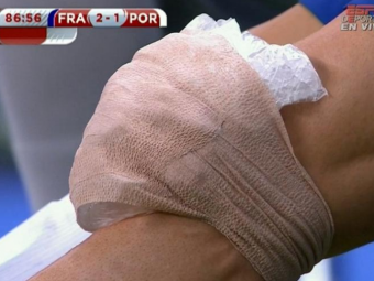 
	Imaginea care le-a dat FIORI RECI fanilor Realului! Ronaldo a incheiat meciul bandajat si cu gheata! Ce spune despre accidentare
