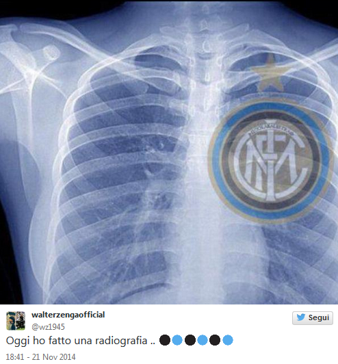 "Azi mi-am facut o radiografie!" Poza pusa de Walter Zenga pe Twitter face senzatie in presa italiana:_2