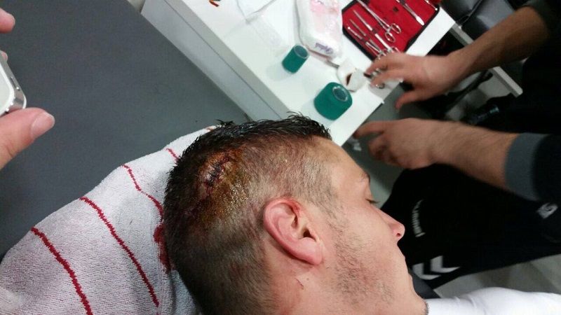 FOTO | Torje si-a spart capul, medicii l-au cusut la finalul partidei! Iordanescu l-a trecut insa pe lista stranierilor_1
