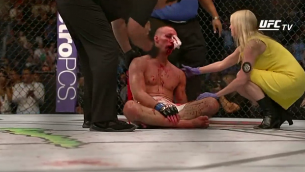 
	Absolut INCREDIBIL! Asta e cea mai SANGEROASA lupta din istoria UFC! Ambii luptatori au ajuns de nerecunoscut la spital! VIDEO
