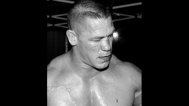 Imagini SOC in wrestling! John Cena a iesit DESFIGURAT din ring! Starul din WWE a fost operat de urgenta_1