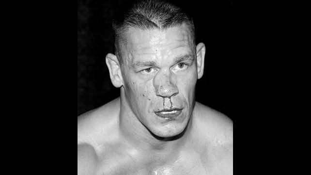 Imagini SOC in wrestling! John Cena a iesit DESFIGURAT din ring! Starul din WWE a fost operat de urgenta_4