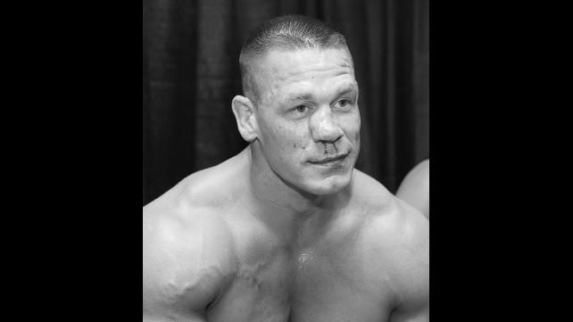 Imagini SOC in wrestling! John Cena a iesit DESFIGURAT din ring! Starul din WWE a fost operat de urgenta_6