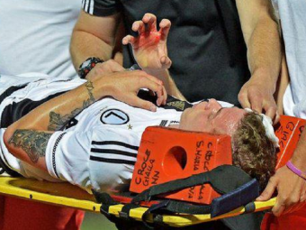 
	Imagini socante in Europa League: meciul Legiei a fost suspendat dupa ce un jucator a fost lovit in cap cu o piatra!
