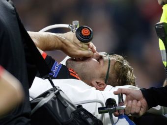
	FOTO 18+ | Pustiul Luke Shaw, accidentat in meciul lui Manchester United cu PSV, a fost operat. Cum poate sa arate piciorul sau
