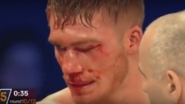 
	A iesit din ring pe picioarele lui, dar medicii s-au speriat dupa meci: boxerul Nick Blackwell este in coma! VIDEO
